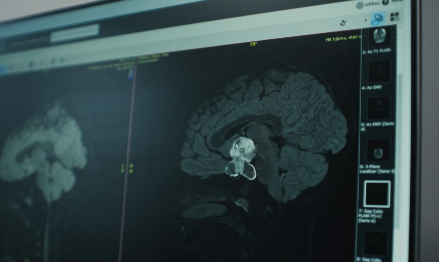 Turning Genomic Data into Clinical Impact